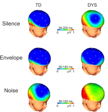 Fig. 3. Electrophysiological data. Topographical maps for the interaction be- be-tween the e ﬀ ects of group and condition