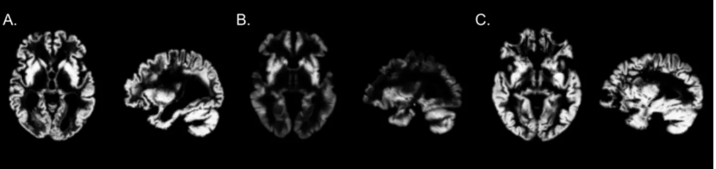 Figure 2: A. Example of image that passed the quality check. B. Example of image removed during the first step  of the quality check