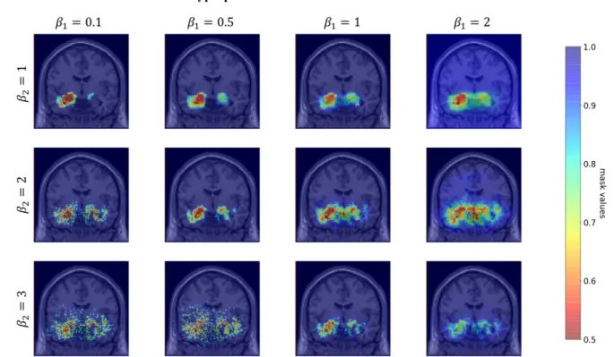 Figure 3: Comparison of masks obtained for different values of the visualization hyperparameters 