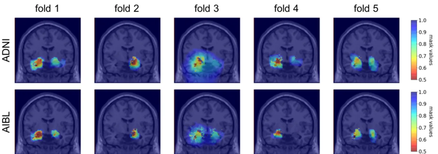 Figure 5: Coronal view of the group masks trained on ADNI (first line) and AIBL (second line)