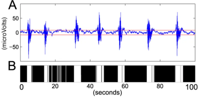 Figure 1. Illustrative example of burst suppression