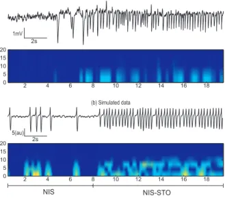 Figure 3: Real (a) and simulated (b) times series and their spectrograms [7].