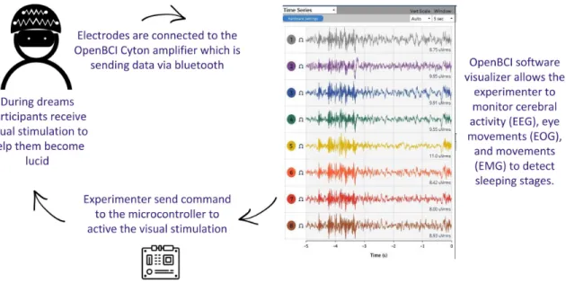 Figure 2: Cerebral activity, eye movements and movements are monitored and visualized in real-time to determine the sleep stage the volunteer is going through