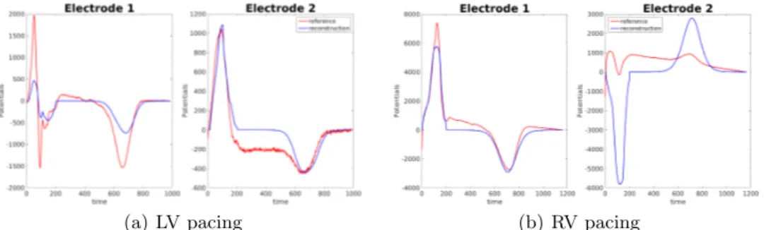 Fig. 11. Reconstructed potentials for experimental data. Electrode 1: close to the heart, Electrode 2: right hip