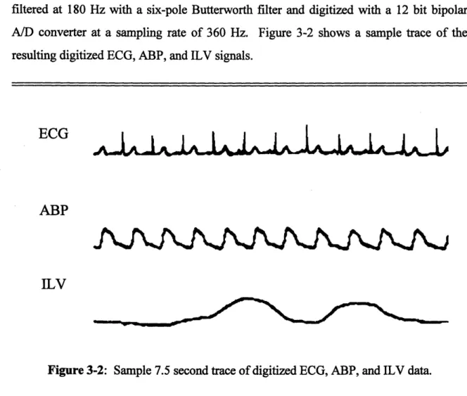 Figure 3-2:  Sample  7.5  second trace of digitized  ECG, ABP, and ILV  data.
