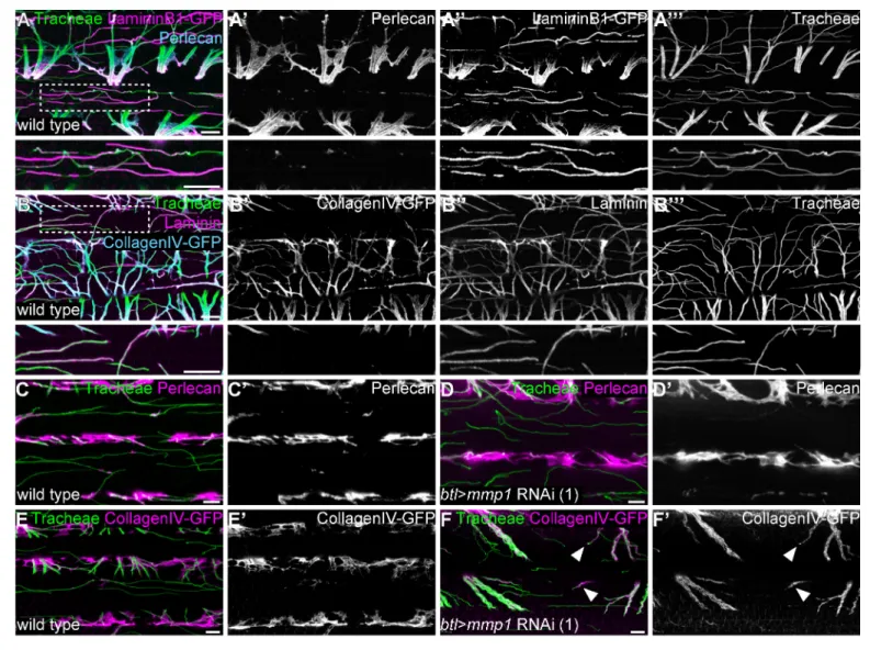Figure supplement 1. Basement membrane around tracheal branches increases during IFM development.