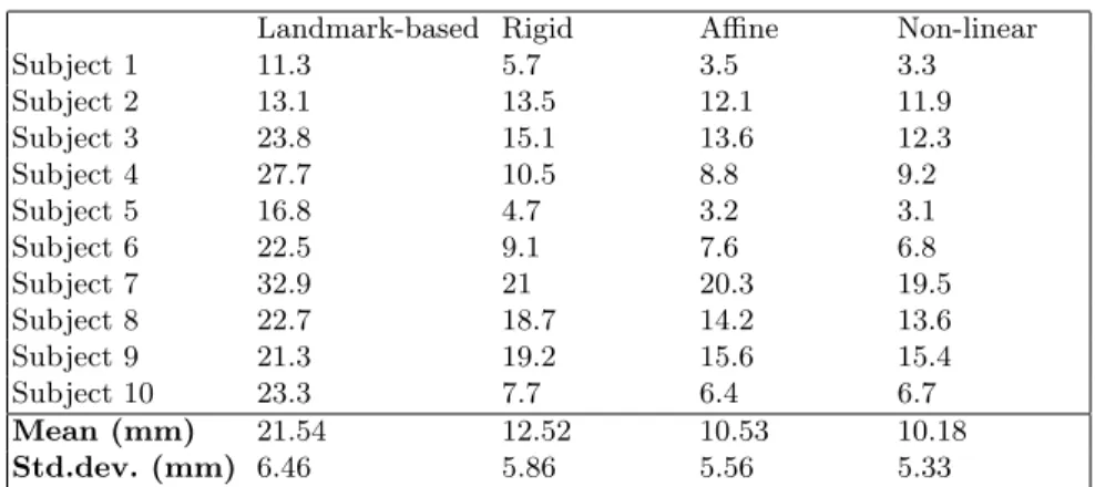Table 1. Results of the surface-based localization of the DLPFC when compared to the reference DLPFC