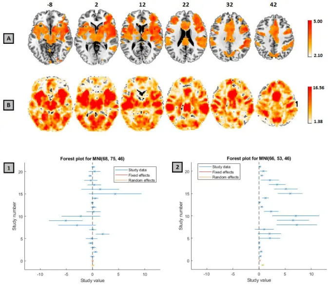 Figure 1: The thresholded Z map, from a meta-analysis of the 21 pain studies, reported in [2] (A) and the  Q-statistic P-Value map thresholded at a corresponding FDR value of 0.05 (B)