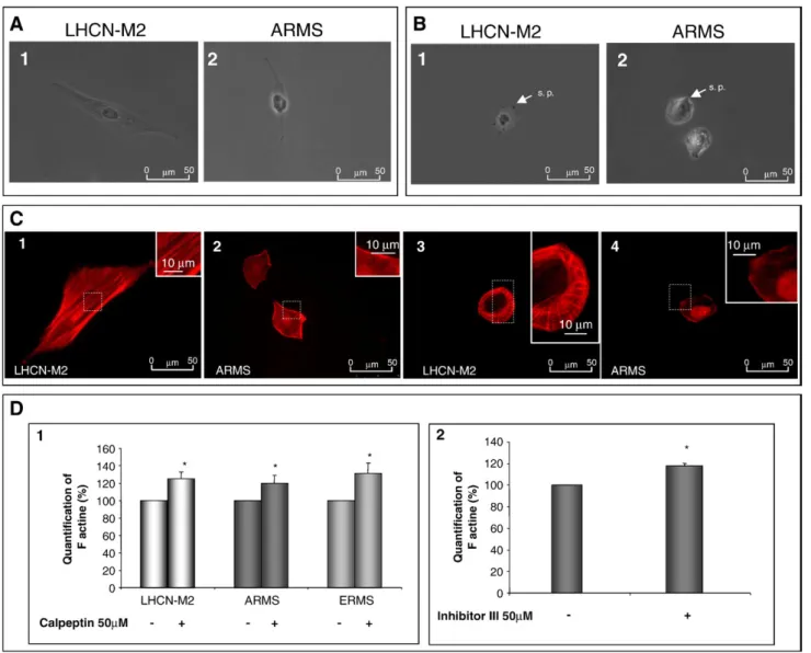 Fig. 2 – Implication of calpains in cell adhesion. Adhesion rates of all cell lines (A) and adhesion rates of LHCN-M2 (B1) and ARMS cells (B2) in calpeptin presence (40 μ M or 60 μ M) or not