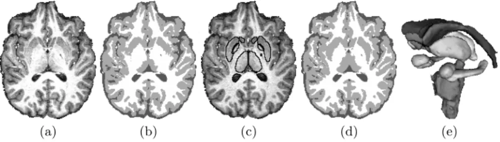 Fig. 2. Real 3T brain scan (a). (b): tissue segmentation by FBM-T. (c) and (d): struc- struc-ture segmentation by FBM-TS and corresponding improved tissue segmentation