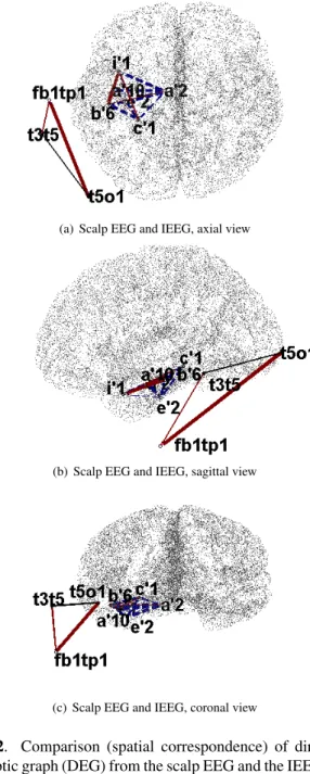 Fig. 1. (a) Implantation scheme of the IEEG electrodes (sagittal view); (b) 10/20 system of scalp EEG electrodes’