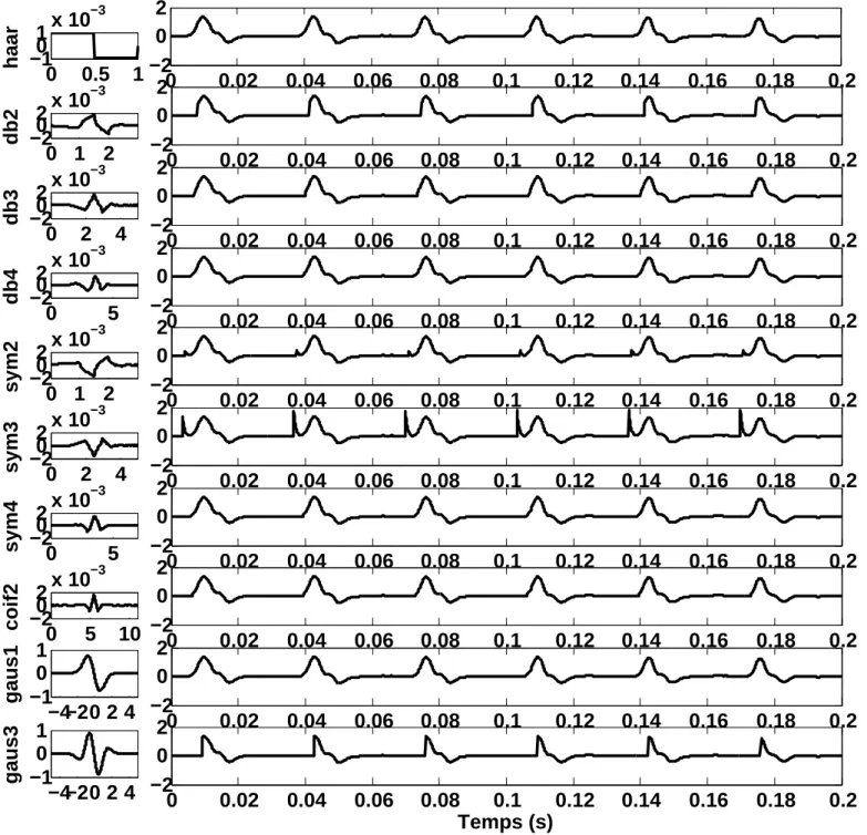 Fig. 5. Example of artifacts removal with haar wavelet (haar), Daubechies wavelets (db2, db3, db4), Symlets wavelets (sym2, sym3, sym4), Coiflet wavelet (coif2) and Gaussian wavelets (gaus1, gaus3) applied on the V EMG signal from the figure 2a.