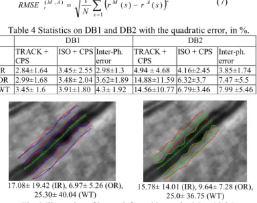 Table 2 Auto vs. Phy ref  for TRACK+PCS and ISO+CPS models, and  inter-physician relative error for inner radius, outer radius and  perivascular inflammation thickness, evaluated on DB2, values in %
