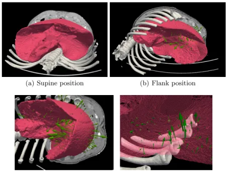Fig. 6. Evaluation of the method on porcine liver deformation induced by re-positioning the pig from supine to flank positions (a,b)