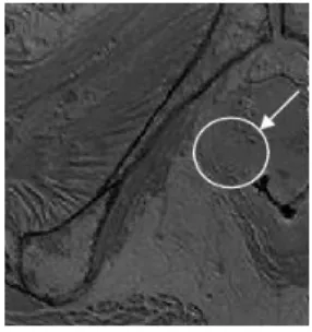 Fig. 2. Volumes bruts reconstruits des organes 