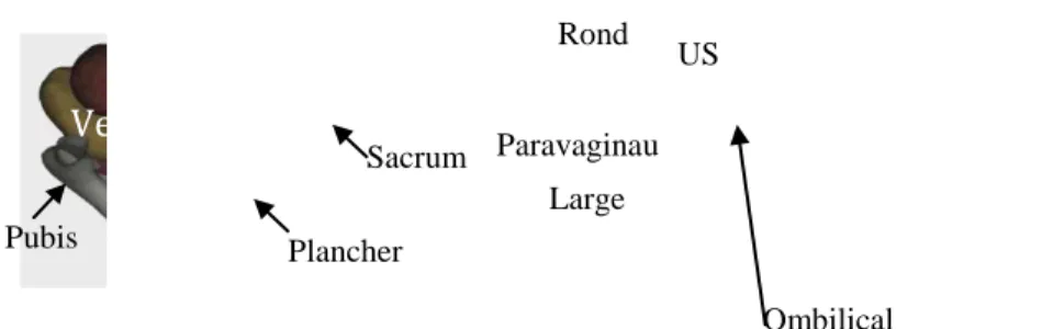 Fig. 6. Modèle numérique fonctionnel de la femme non enceinte constitué de l’utérus (U), du vagin (V), de  la vessie (Ve), et du rectum (R) ainsi que des paires de ligaments utéro-sacrés (US), ronds, larges, 