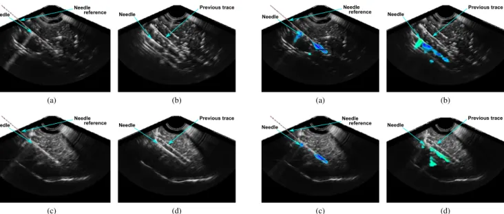 Fig. 3. Needle in color-Doppler US images in (a), (b) beef liver and (c), (d) pork tenderloin