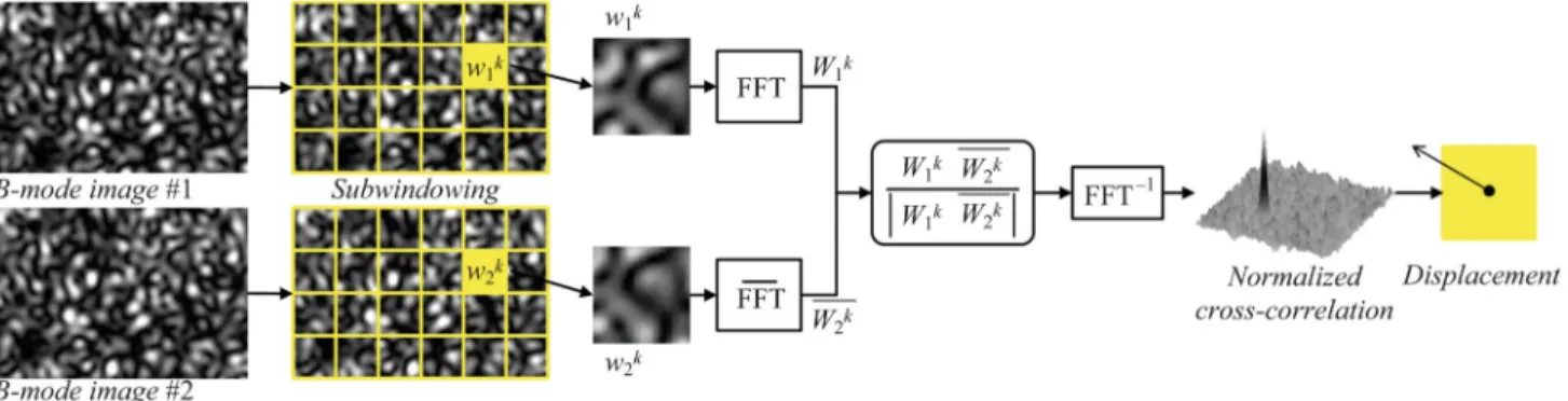 Fig. 1. Speckle tracking algorithm implemented in the Fourier domain based on the phase correlation; from [8] with permission.