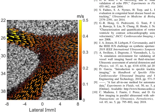 Fig. 4. B-mode image superimposed with the flow estimate for the carotid bifurcation during systole.