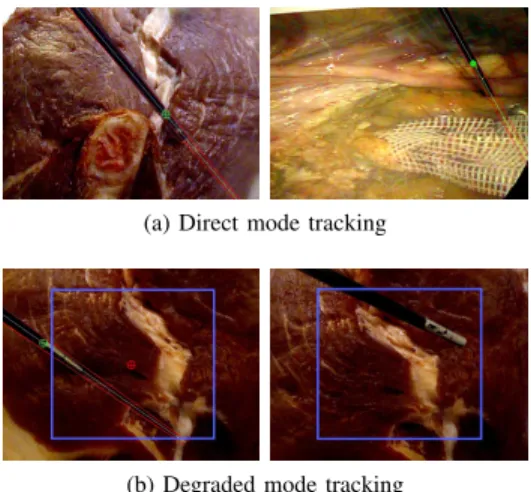 Fig. 4: Detection of two instruments in the field of view. The chose primitive is represented by green point.