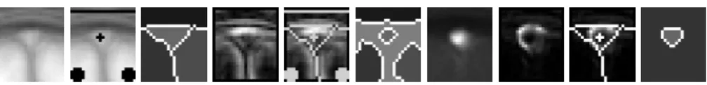 Figure 2. Initialization process. From left to right: MRI average slice ( n8o4p