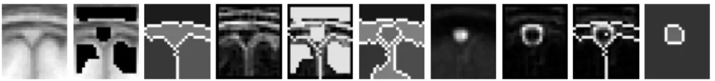 Figure 3. A step of the iterative process for one slice. From left to right: MRI average slice (n o4p