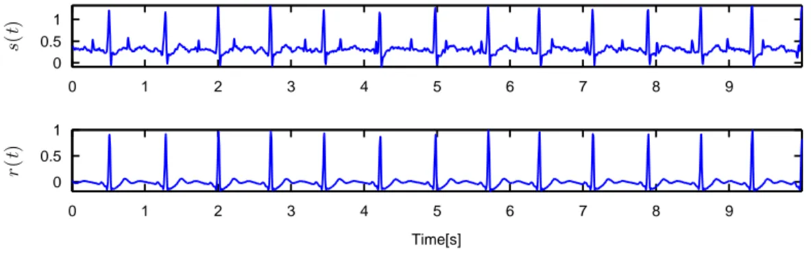 Fig. 1: The abdominal noisy observation channel (on top), and the 16-bit thoracic ECG channel (on bottom)