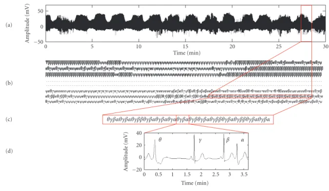 Figure 1: Overview of symbolic analysis: (a) raw data corresponding to Patient 106 in the MIT-BIH arrhythmia database