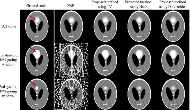 Fig 3. End-systole: profiles in the moving area  Fig.3  shows  a  profile  through  the  moving  area  in  the  reconstructions  obtained  at  end-systole  (bottom  line  of  Fig.1),  on  which  the  gain  in  temporal  resolution  over  the  FBP with all 