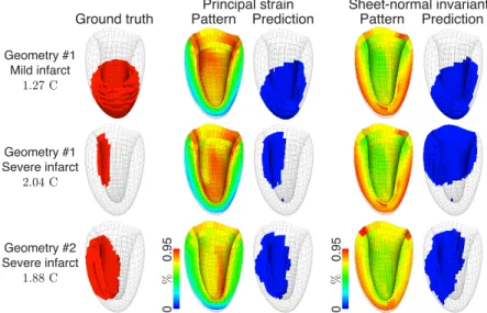 Figure 2: Infarct localization for some pathological cases based on principal strain and sheet-normal invariant; amongst the best and the worst parameters, respectively.