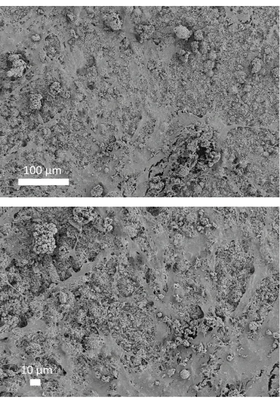 Figure 9: SEM observation of ADSC cells in contact with the Zn5 DCPD sample. Initial  magnifications: x200 (top picture) and x400 (down picture)