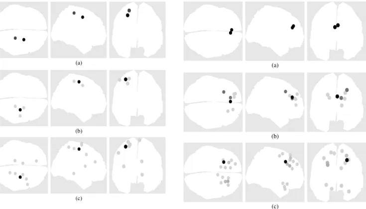 Fig. 8. Brain activity for multiple close dipoles (activation # 4 that has a 30-mm separation between dipoles).