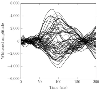 Fig. 12. Brain activity for the auditory evoked responses from 80 to 126 ms.