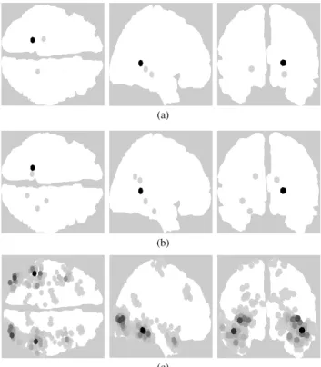 Fig. 13. Brain activity for the faced evoked responses for 160 ms.