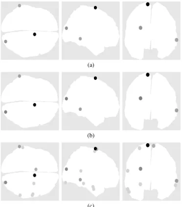 Fig. 5. Brain activity for a multiple distant dipole experiment (activation # 2 that has two active dipoles).