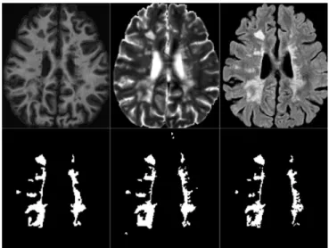 Fig. 1. Dataset training 02 time point 1: Top, from left to right: T1-w, T2-w and FLAIR