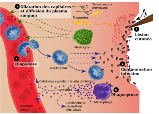 Figure 1 : La réaction inflammatoire.         