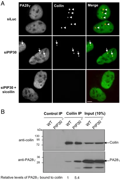 Fig. 5. PIP30 depletion induces accumulation of PA28 γ in residual CBs and enhances the interaction of PA28γ with coilin