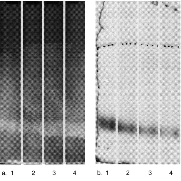 Figure 3-2.  [a.]  PAGE for  samples from  cultures  grown at different  concentrations  of zinc  and Co, purified  and concentrated  on a CA affinity column,  then assayed for CA activity  using  the color pH indicator  bromcrescol  purple,  with  low pH 