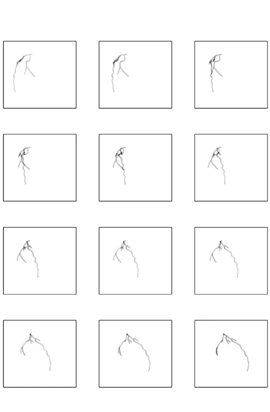 Figure 4.2: 12 projections of the left coronary tree simulated binary volume at phase s = 1, from 10 ◦ to 120 ◦ .