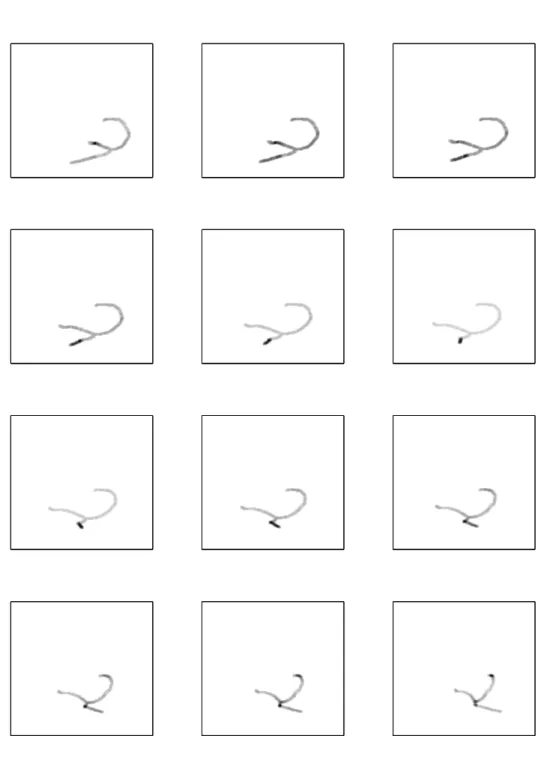 Figure 4.3: 12 projections of the right coronary tree simulated binary volume at phase s = 1, from 10 ◦ to 120 ◦ .