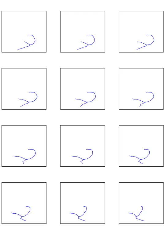 Figure 4.5: 12 extracted centrelines of the projected right coronary tree simulated binary volume at phase s = 1, the projections being taken from 10 ◦ to 120 ◦ .