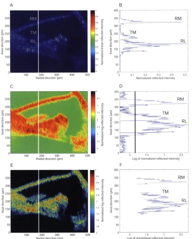 Figure  4-3:  Cross-section  of the  organ  of Corti  in  the  apical  turn  of the  Zn  stu guinea pig  cochlea