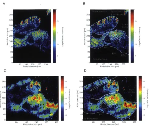 Figure  4-8:  Two  in  situ  \Mongolian  gerbil  apical  cross-sections  with  daiaged  Reiss-