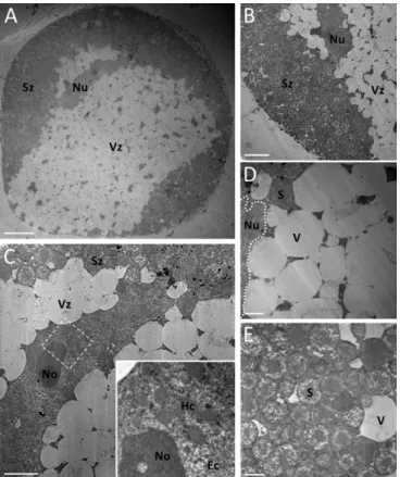 Fig. 2. TEM of A. pisum degenerative bacteriocytes. (A) Low-magnification image of a degenerative bacteriocyte cell exhibiting extensive cytoplasmic vacuolation and an abnormal nuclear shape
