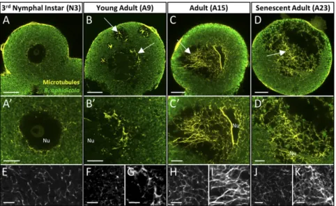 Fig. 4. Organization of the bacteriocyte microtubule network during the degeneration process