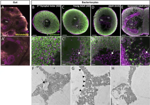 Fig. 5. ER-derived origin of hypervacuolation in degenerative bacteriocytes. (A – E ′ ) Confocal images (A – E) and magnified views of ER organization (A ′– E ′ ) in whole-mount IHC-stained gut (controls; A and A ′ ) and bacteriocytes from N3 (B and B ′ ),