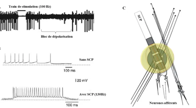 Figure  1.3.a:  Effet  de  la  SCP:  A.  bloc  de  dépolarisation  d’un  neurone  de  la  cible  de  stimulation  après  une  microstimulation  du  thalamus  (enregistrement  humain)  (McIntyre  et  al.,  2004)  B