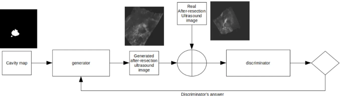 Figure 1. Stage I: GAN generation of an iUS with resection from a cavity map and real after-resection iUS images.