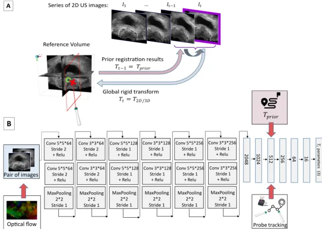 Figure 1. Method. A) Problem statement. The objective is to estimate the rigid transform parameters between a 2D US image and the reference volume in an end-to-end fashion, being given additional information such as previous registration prior, relative pr